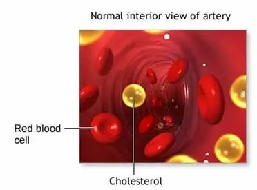 Cholestrol